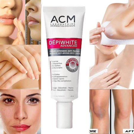 كريم تفتيح مكثّف مضاد للبقع البنية  ACM